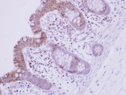GBF1 Antibody, Novus Biologicals 0.1mL; Unlabeled:Antibodies, Polyclonal