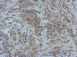 GBP5 Antibody, Novus Biologicals 0.1mL; Unlabeled:Antibodies, Polyclonal