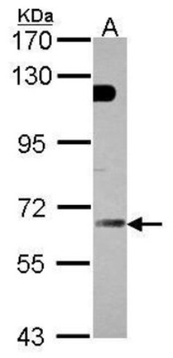GBP5 Antibody, Novus Biologicals 0.1mg; Unlabeled:Antibodies, Polyclonal