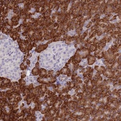 GBP7 Antibody, Novus Biologicals 25 &mu;L, Unlabeled:Antibodies, Polyclonal