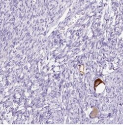 GBX1 Antibody, Novus Biologicals 0.1mL; Unlabeled:Antibodies, Polyclonal