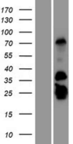 Novus Biologicals&trade;&nbsp;GCAP2 Overexpression Lysate