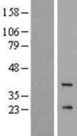 Novus Biologicals&trade;&nbsp;GCAP3 Overexpression Lysate