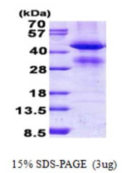 Novus Biologicals&trade;&nbsp;Recombinant Human GCAT His Protein