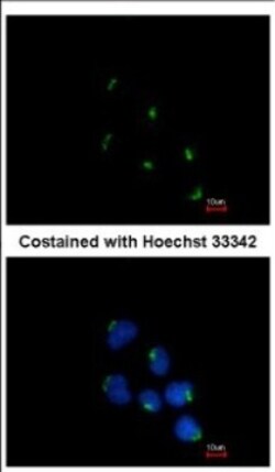 GCC1 Antibody, Novus Biologicals 0.1mL; Unlabeled:Antibodies, Polyclonal
