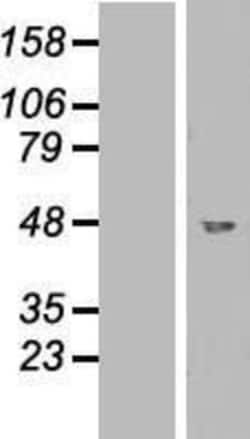 Novus Biologicals&trade;&nbsp;GCDH Overexpression Lysate