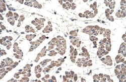 GCDH Antibody, Novus Biologicals 0.1mg; Unlabeled:Antibodies, Polyclonal