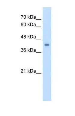 GCDH Antibody, Novus Biologicals 0.1mg; Unlabeled:Antibodies, Polyclonal