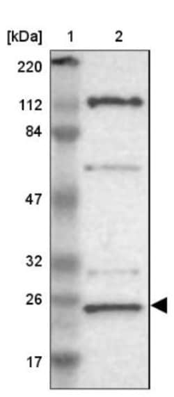 GCET2 Antibody, Novus Biologicals 25 &mu;L; Unlabeled:Antibodies, Polyclonal