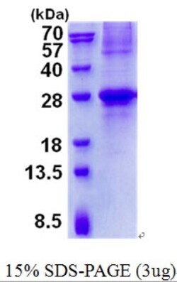 Novus Biologicals&trade;&nbsp;Recombinant Human GCET2 His Protein