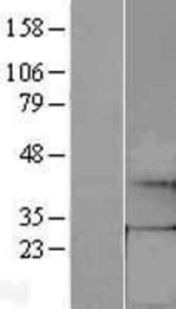 Novus Biologicals&trade;&nbsp;GCH1 Overexpression Lysate