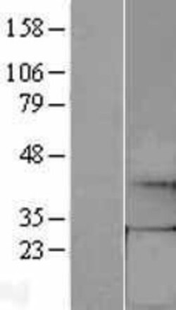 Novus Biologicals&trade;&nbsp;GCH1 Overexpression Lysate