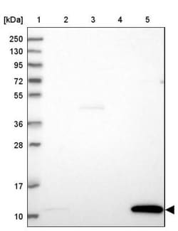 GCHFR Antibody, Novus Biologicals 0.1 mL | Buy Online | Novus Biologicals | Fisher Scientific