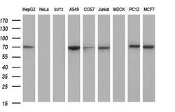 GCLC Antibody (OTI1A3), Novus Biologicals 0.1mL; Unlabeled:Antibodies,