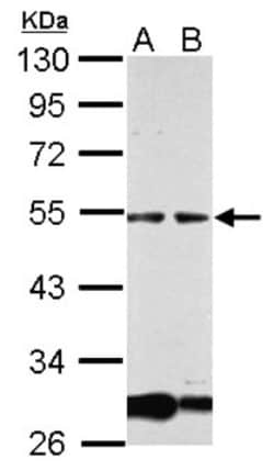 GCM1 Antibody, Novus Biologicals 0.1mL; Unlabeled:Antibodies, Polyclonal