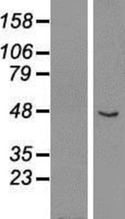 Novus Biologicals&trade;&nbsp;GCM1 Overexpression Lysate