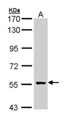 GCM2 Antibody, Novus Biologicals 0.1mL; Unlabeled:Antibodies, Polyclonal