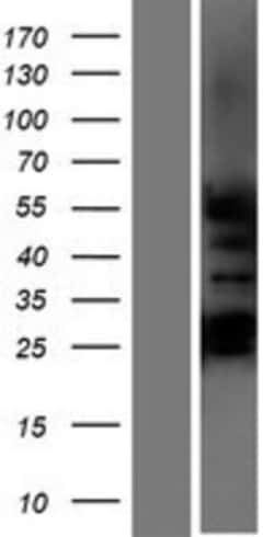 Novus Biologicals&trade;&nbsp;GCNF/NR6A1 Overexpression Lysate