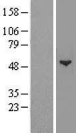 Novus Biologicals&trade;&nbsp;Glucosaminyl (N-acetyl) Transferase 1/GCNT1 Overexpression Lysate