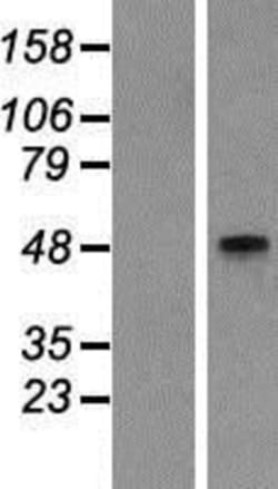 Novus Biologicals&trade;&nbsp;GCNT2 Overexpression Lysate