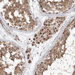 GCNT2 Antibody, Novus Biologicals:Antibodies:Primary Antibodies
