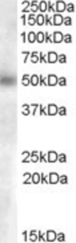 GCNT3 Antibody, Novus Biologicals 0.1mg; Unlabeled:Antibodies, Polyclonal