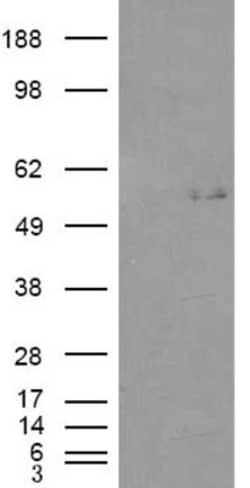 GCNT3 Antibody, Novus Biologicals 0.1mg; Unlabeled:Antibodies, Polyclonal