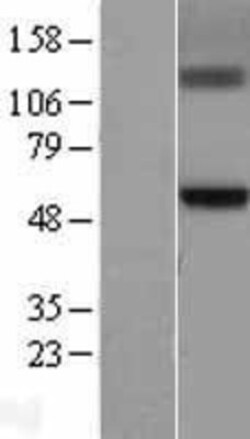 Novus Biologicals&trade;&nbsp;GCNT3 Overexpression Lysate