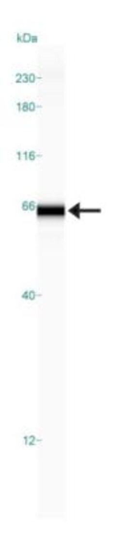 GCNT3 Antibody, Novus Biologicals 0.1mL; Unlabeled:Antibodies, Polyclonal