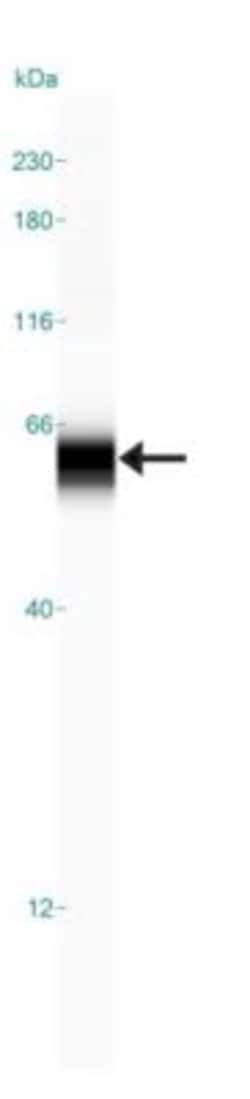 GCNT3 Antibody, Novus Biologicals 0.1mL; Unlabeled:Antibodies, Polyclonal