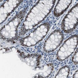 GCR2 Antibody, Novus Biologicals:Antibodies:Primary Antibodies