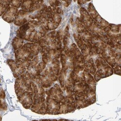 GCS1 Antibody, Novus Biologicals 0.1mL; Unlabeled:Antibodies, Polyclonal