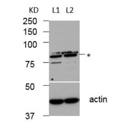 GCS1 Antibody, Novus Biologicals 0.1mL; Unlabeled:Antibodies, Polyclonal