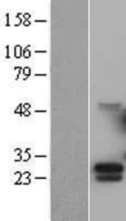 Novus Biologicals&trade;&nbsp;G-CSF Overexpression Lysate