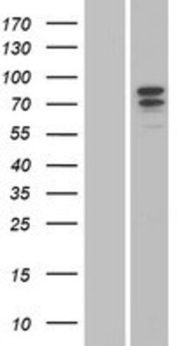 Novus Biologicals&trade;&nbsp;G-CSFR/CD114 Overexpression Lysate