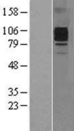 Novus Biologicals&trade;&nbsp;G-CSFR/CD114 Overexpression Lysate