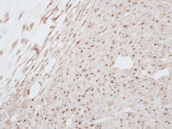 G-CSFR/CD114 Antibody, Novus Biologicals 0.1mL; Unlabeled:Antibodies, Polyclonal