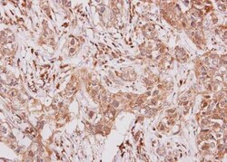 G-CSFR/CD114 Antibody, Novus Biologicals 0.1mL; Unlabeled:Antibodies, Polyclonal