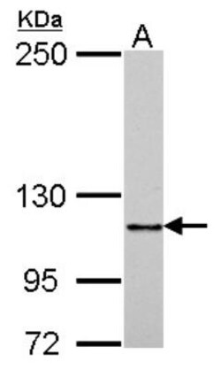 G-CSFR/CD114 Antibody, Novus Biologicals 0.1mL; Unlabeled:Antibodies, Polyclonal