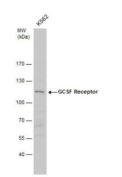 G-CSFR/CD114 Antibody, Novus Biologicals 0.1mL; Unlabeled:Antibodies, Polyclonal