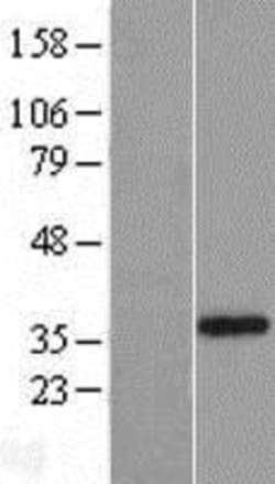 Novus Biologicals&trade;&nbsp;GDC Overexpression Lysate