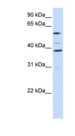 GDC Antibody, Novus Biologicals:Antibodies:Primary Antibodies