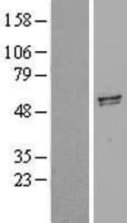 Novus Biologicals&trade;&nbsp;GDF-5/BMP-14 Overexpression Lysate