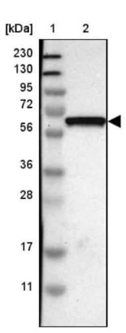 GDF-5/BMP-14 Antibody, Novus Biologicals 0.1mL; Unlabeled:Antibodies, Polyclonal