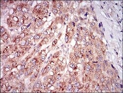 GDF-8/Myostatin Antibody (6E4E6) - BSA Free, Novus Biologicals 0.1mL; Unlabeled:Antibodies,