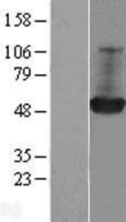 Novus Biologicals&trade;&nbsp;GDI1 Overexpression Lysate