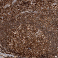 GFR alpha-2/GDNF R alpha-2 Antibody, Novus Biologicals:Antibodies:Primary