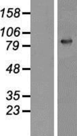 Novus Biologicals&trade;&nbsp;Gelsolin/GSN Overexpression Lysate