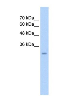 GEM Antibody, Novus Biologicals 0.1mg; Unlabeled:Antibodies, Polyclonal