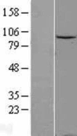 Novus Biologicals™ Gemin 3 Overexpression Lysate
